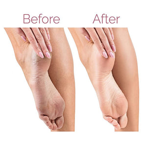 Electric Pedicure Foot File Callus Remover Zambeel - Local Baba - PAK