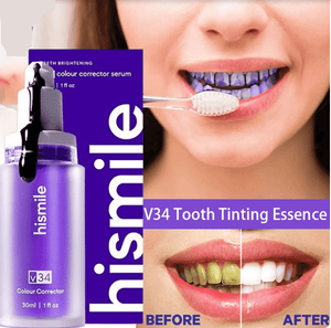 Hismile - Teeth Brightening Serum V34 Zambeel - Local Baba - PAK