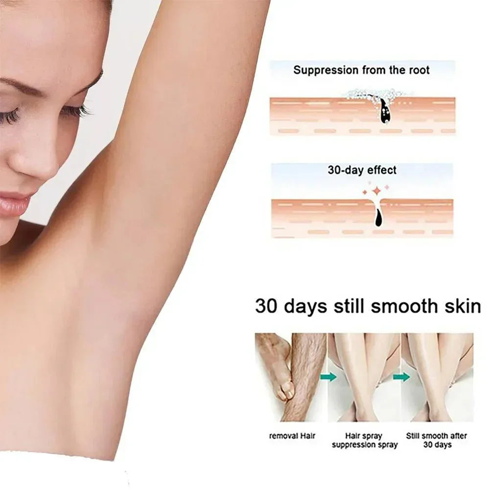Eelhoe - Hair Removal Zambeel