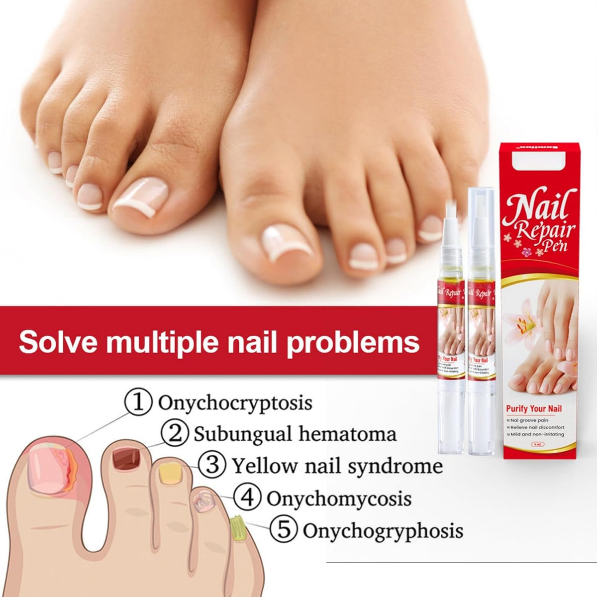 Nail Repair Pen Zambeel